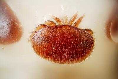 Varroa-Milbe in Vergößerung: Man erkennt ein rötlichen Körper mit feinen Haaren und  dahinter sieht man Glieder einer Bienennymphe